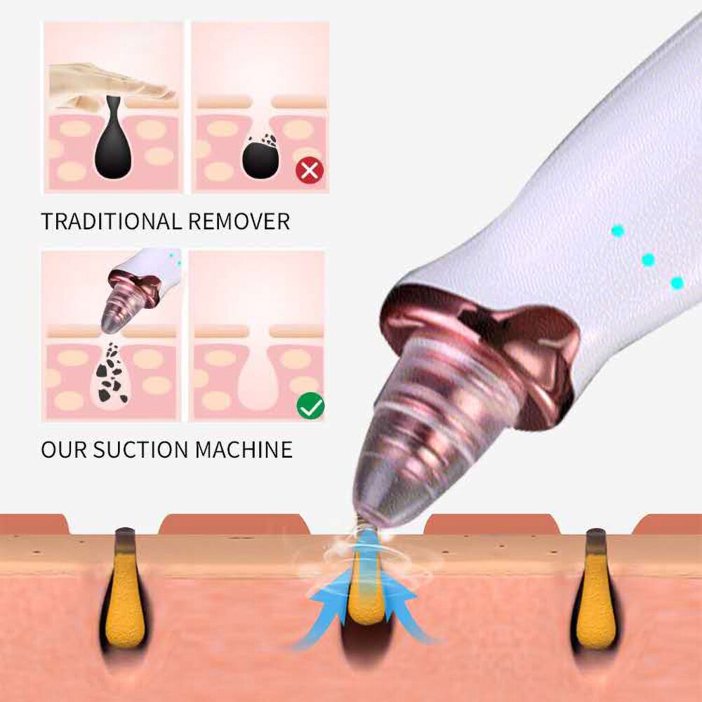 Vacuum Pore Cleaner Face Cleaning Blackhead Remover Tool Blackhead Pore Acne Removal Facial Cleansing Machine Skin Care Device#1