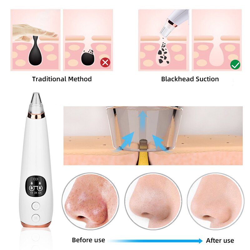 Blackhead Remover USB Charging Facial Pore Cleaner Remove Blackhead Care Tool T Zone Pore Cleaner