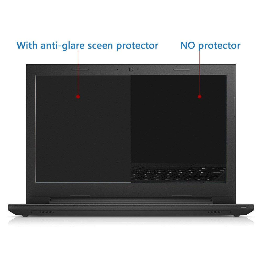5pcs/lot for Razer Blade 15 15.6&quot; Gaming Laptop Screen Protector Notebook Anti-Glare Matte / Hig Clear LCD Screen Guard Film