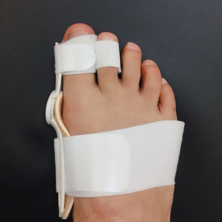 2 stuks Grote Teen Bunion Apparaat Spalk Stijltang 2 gat Hallux Valgus Bretels Teen Correctie Voet Pijnbestrijding Duim Zorg orthopedische: Beige