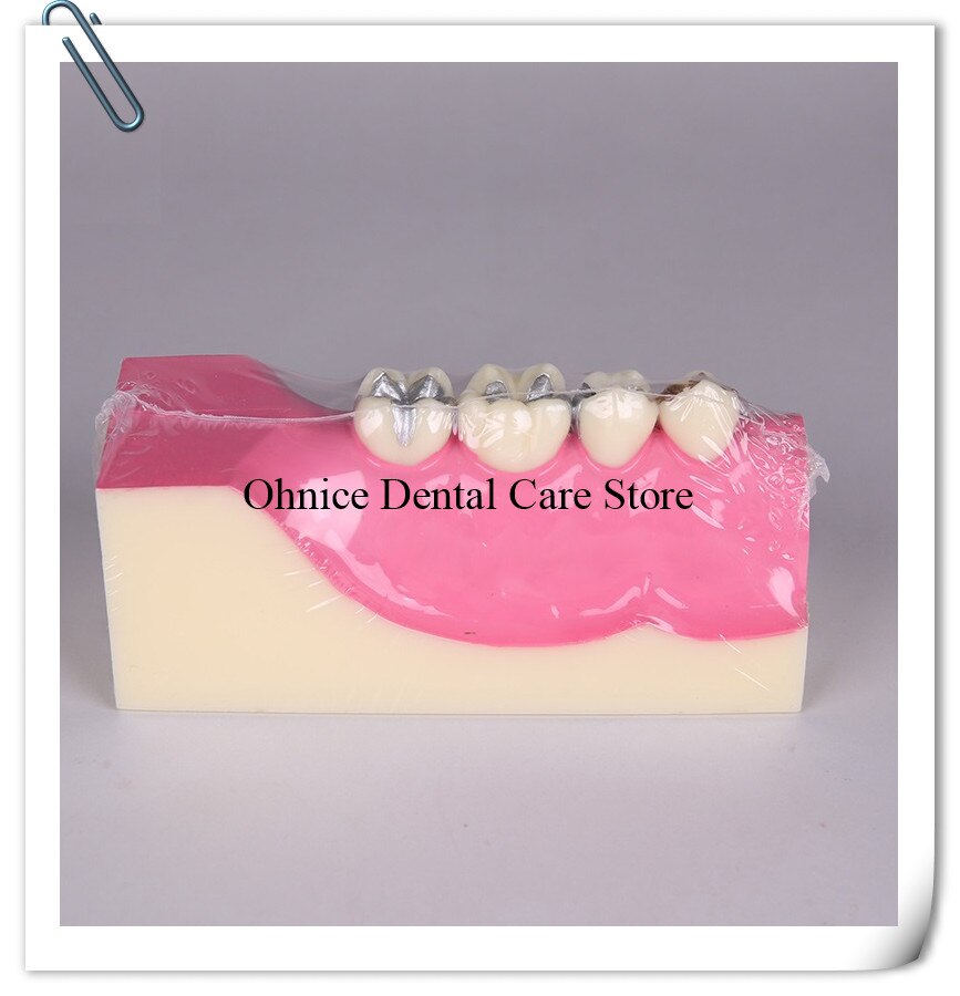 Periodontal disease teeth model M4009/dental teaching model Molar cross section study teeth model