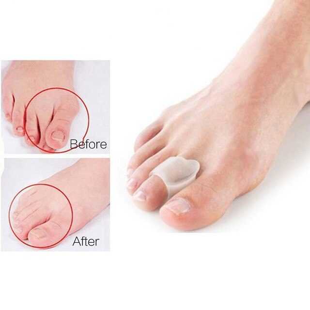 Toe Separator Bunion Corrector Foot Protector Toe Straightener Thumb Silicone Gel Foot Fingers Adjuster Feet Pads Relief Pain: style E-1pair
