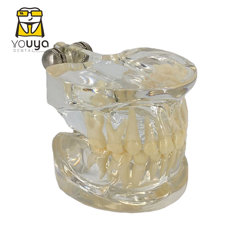 Dental Model For Children Deciduous Tooth Permanent Teeth Alternating Study Teathing Pediatric Dental Pathology Preventive Model