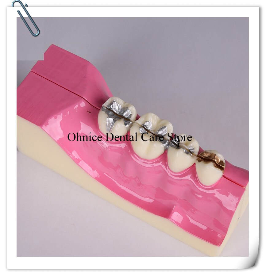 Periodontal disease teeth model M4009/dental teaching model Molar cross section study teeth model