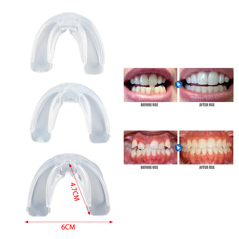 Corrector de dientes de ortodoncia para adultos, herramientas de silicona para enderezar los dientes tapados, cuidado Dental, 3 fases