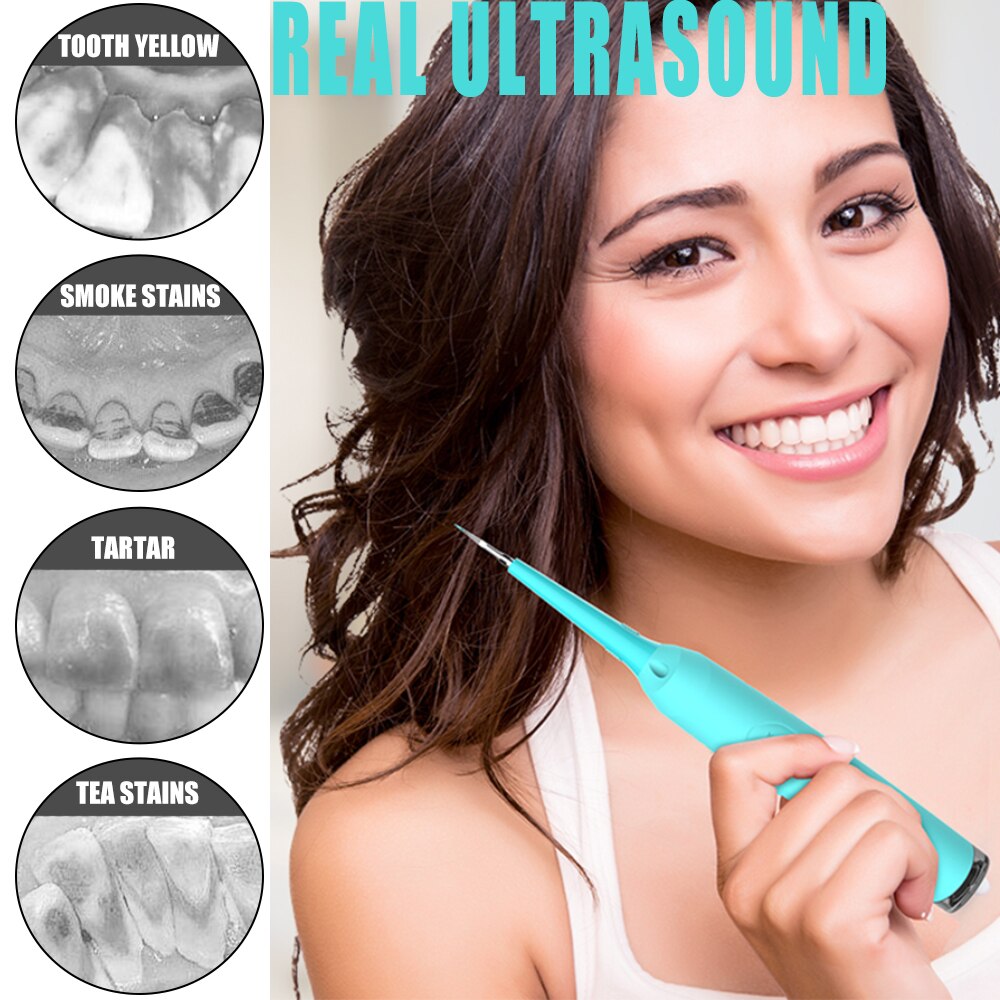 Remover elektrisk ultraljud sonisk oral irrigator tandvård tandkalk tandsten tandkött tandläkare vattentät vitare tänder cleane