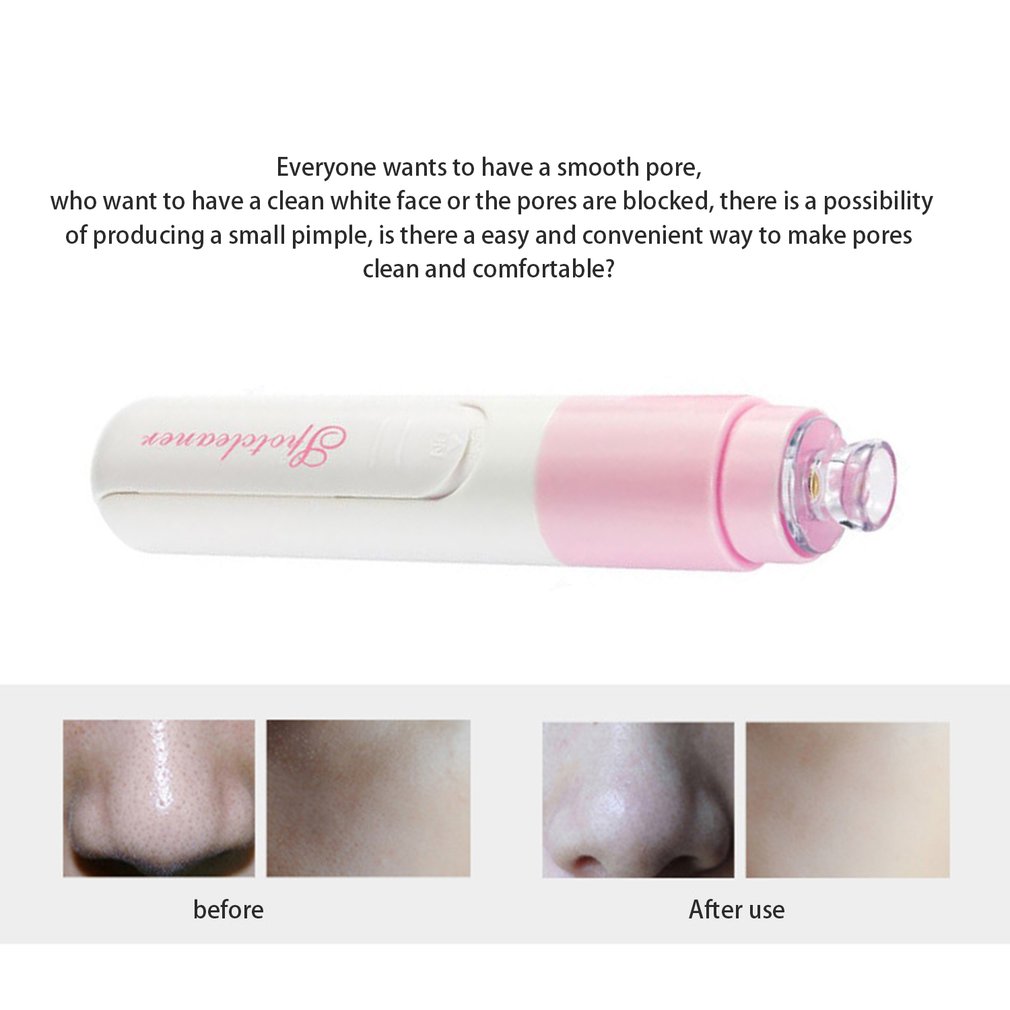 Mini Face Pore Cleaner Blackhead Remover Vacuum Acne Pimple Removal Cleansing Pore Electric Blackhead Clean Beauty Machine