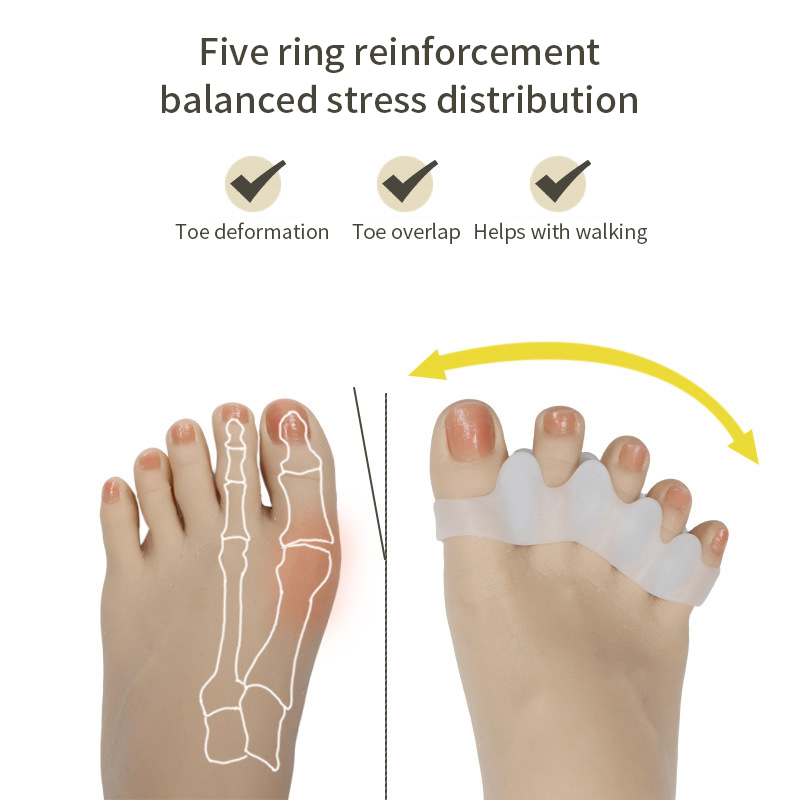 Siliconen Vinger Teenbeschermer Teenseparators Brancards Stijltang Bunion Protector Pijnbestrijding Voetverzorging 5 kleuren