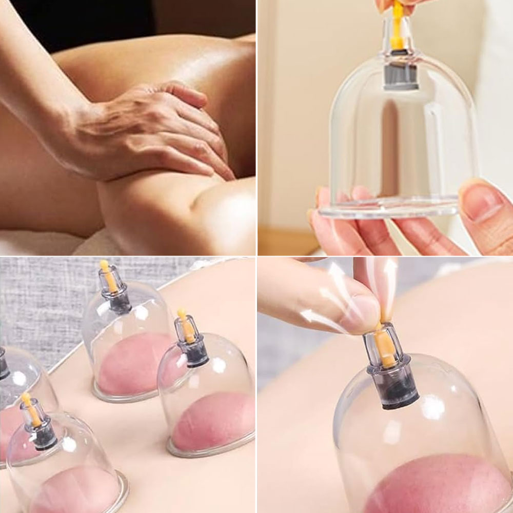 1 Stück Vakuum-Schröpfglas für Massage, Chinesische Medizin, Physiotherapie, Anti-Zellulitis Saugnapf, Körpermassagegerät für Gesundheitspflege