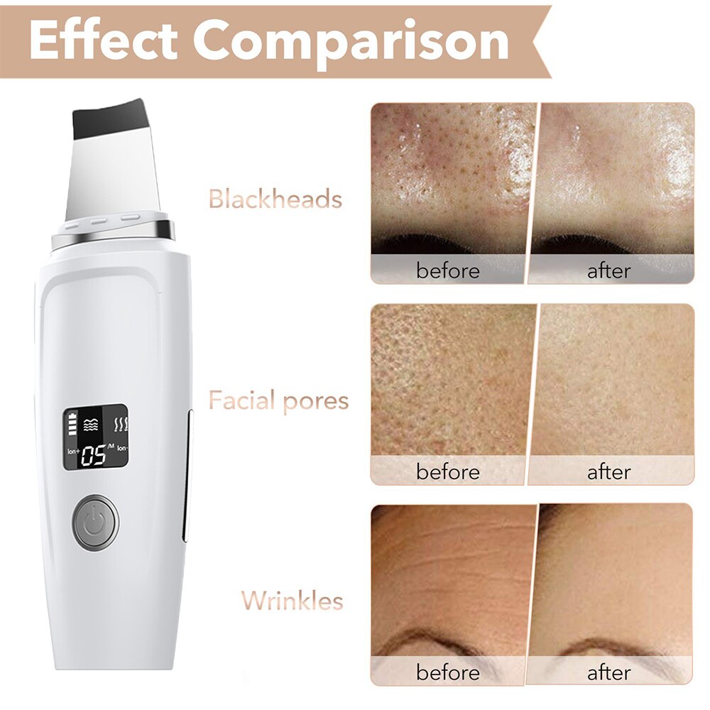 Electric Ultrasonic Skin Scrubber Blackhead Pimple Remover Pore Cleaning Face Peeling Tools EMS Massage Face Lifting Machine