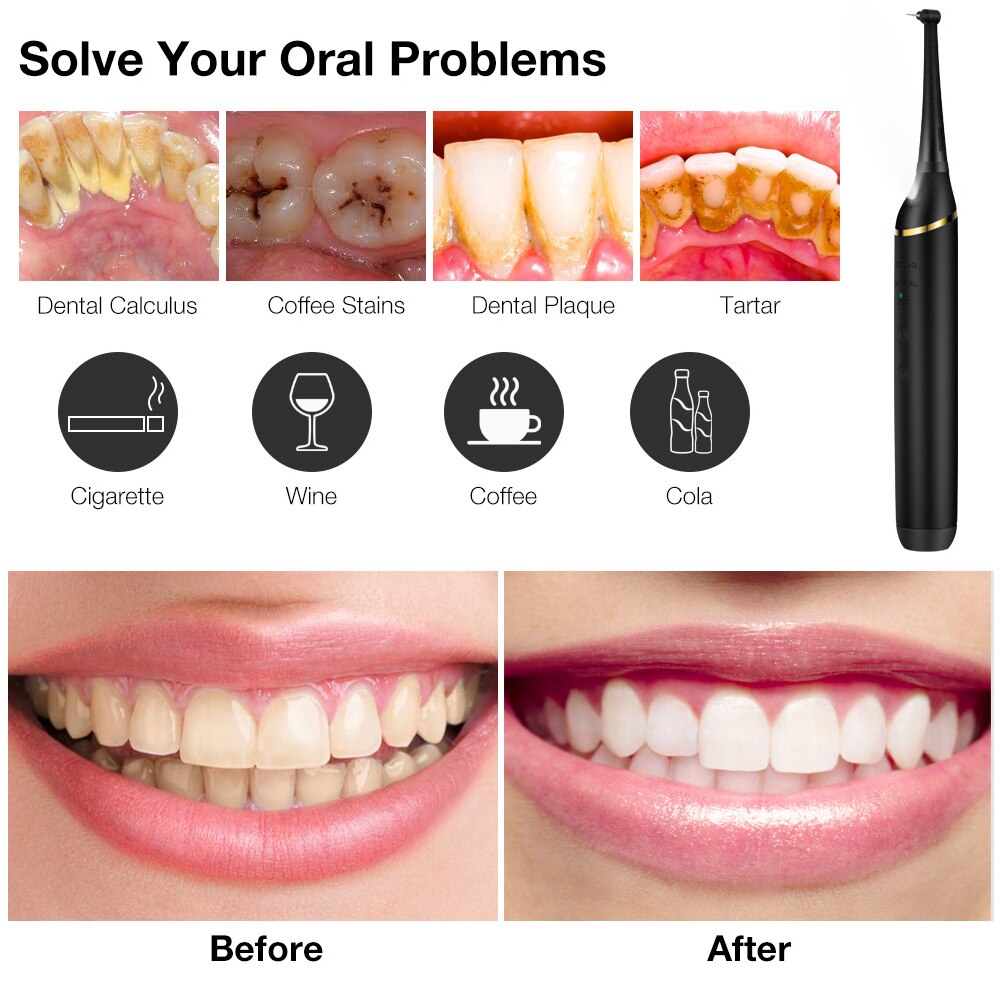 USB Rechargeable Travel Vibration Oral Irrigator Toothbrush Stainless Steel Home Dentist Electric Teeth Cleaner Led