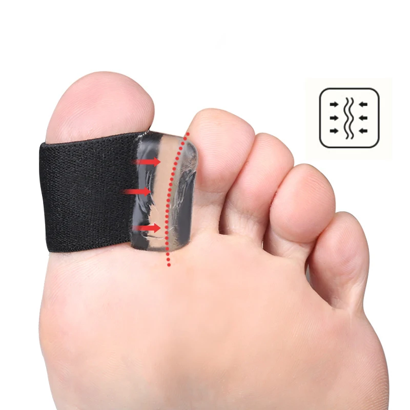 1 Stücke Spannungsgurt Hallux Valgus Schutz Daumen Zehenspreizer Schmerzlinderung Zehen Finger Separator Zehenschiene Ballen Erzähler Werkzeug