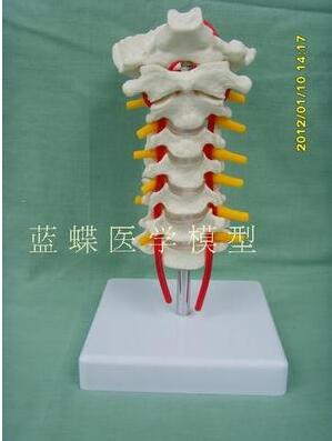 Modèle de vertèbre cervicale avec artère carotide, os occipital, disque intervertèbre et enseignement nerveux, modèle de vertèbre cervicale