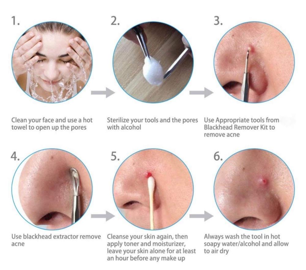 Vacuum Blackhead Remover Extractor USB Rechargeable Facial Acne White head Pimple Pore Nose Face Cleanser Tool Device