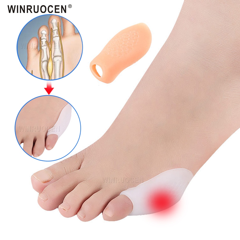 2Pcs Silicone Small toe Separator Bunion Splint Small Valgus Orthosis Correction Overlapping Spreader Foot Protector Inserts