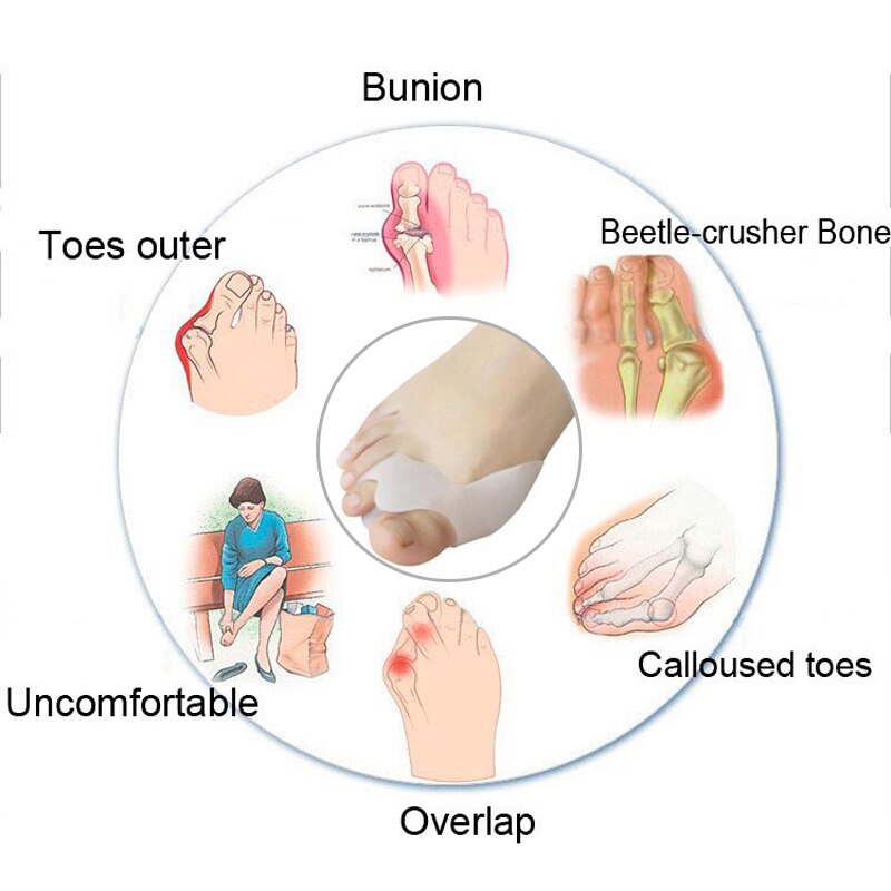 1Pcs Hallux Valgus Spalk Teen Correctie Bicyclische Bunion Duim Orthopedische Bone Grote Teen Separator Vinger Pedicure Voet Inlegzolen