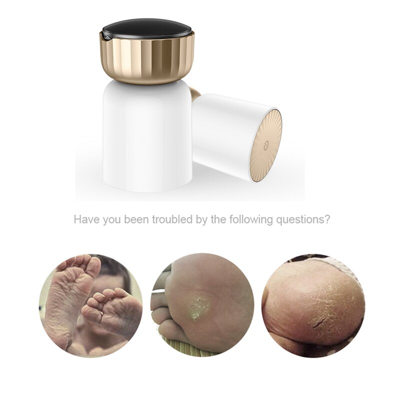Elektrisk peeling fot förhårdnad remover peeling fotfil peeling peeling maskin fotvårdsverktyg