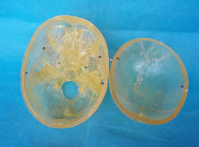 Menselijk 1:1 Levensgrote Transparante Schedel Model Skelet Skelet Model Anatomie Skelet Anatomie Hersenen Schedel Medische Onderwijs Model