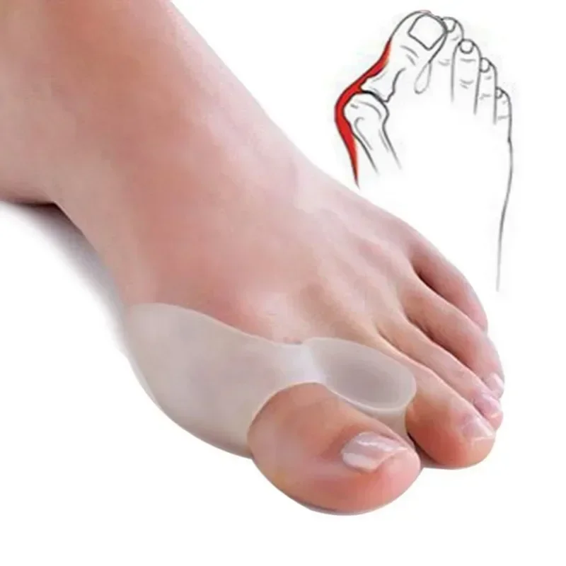 2 Stuks Siliconen Gel Duim Corrector Bunion Voet Teen Hallux Valgus Protector Separator Vinger Stijltang Richter Voetverzorging Tool