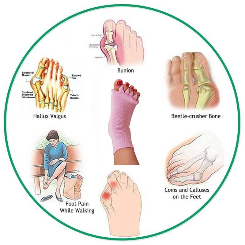 Calcetines de cinco dedos para juanetes, Corrector, separadores ortopédicos para el dolor, Hallux Valgus, cuidado de los pies, herramientas de pedicura, 1 par