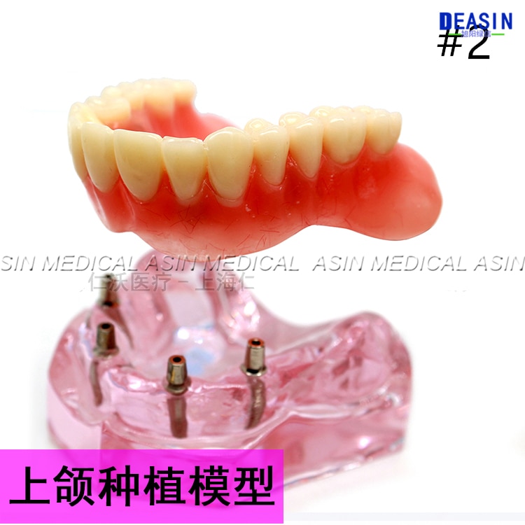 1 pc x Resin Coverage dental implant model dentures Removable teeth model for dentist study Deasin
