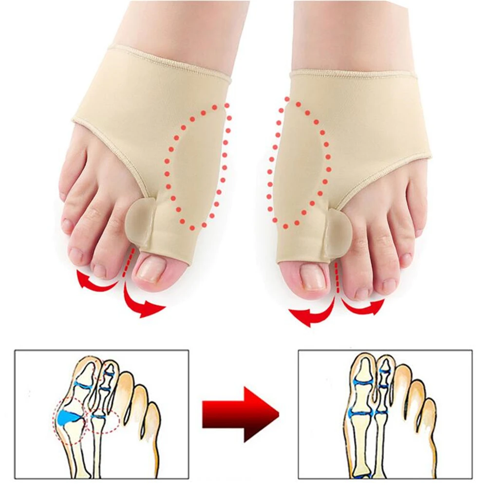 1 paar Zehe Separator Hallux Valgus Ballen Korrektor Hammer Kappe Haarglätter Fuß Schmerzen Linderung Orthopädische Pedikübetreffend Werkzeuge Fuß Pflege