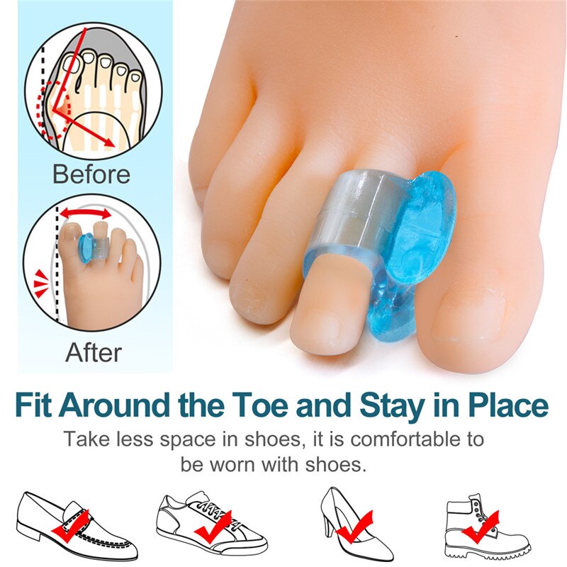 2pcs Toe Separator Insoles Ring Separation Hallux Valgus Correction Pad Foot Care Orthopedic Foot Toe Hallux Valgus Correct
