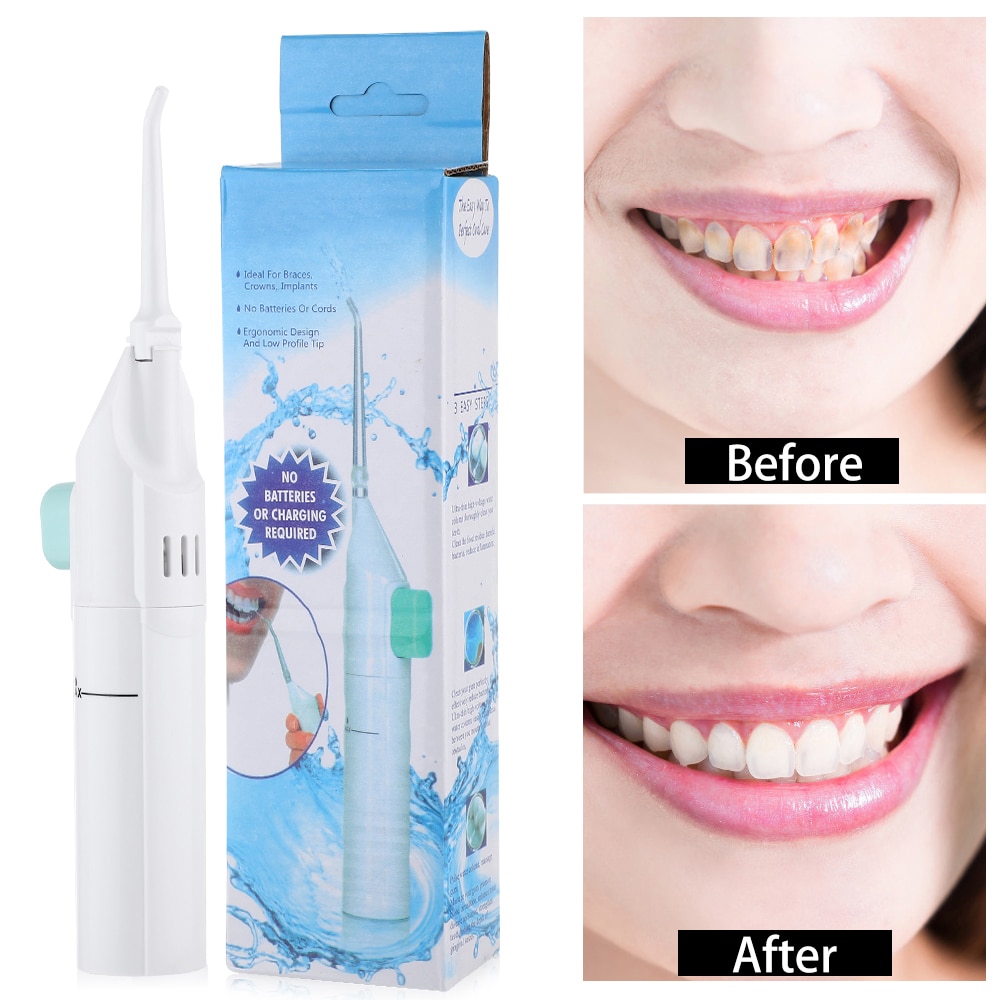 Draagbare Dental Scaler Floss Dental Water Jet Tooth Pick Geen Batterijen Dental Cleaning Whitening Cleaner Kit