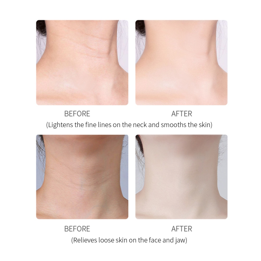 3 Colors LED Photon Therapy Neck and Face Lifting Tool IPL Vibration Skin Tighten Reduce Double Chin Anti-Wrinkle Remove Device