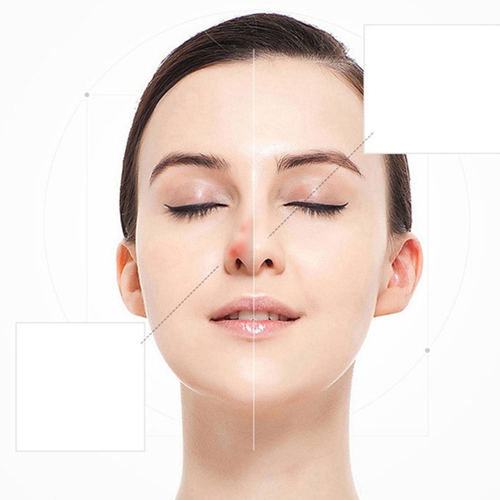 Portable Light Facial Beauty Instrument Home Lcd 9 File Remove Mole Pen Micro Freckle Pen Sweep Spot Machine