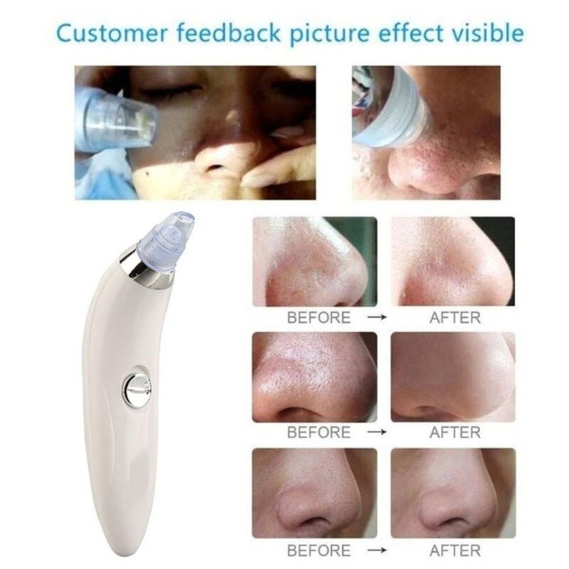 Blackhead Remover Facial Deep Cleansing Vacuum Acne Pore Cleaner pimple remover tools Removal Suction Facial Skin Care Machine