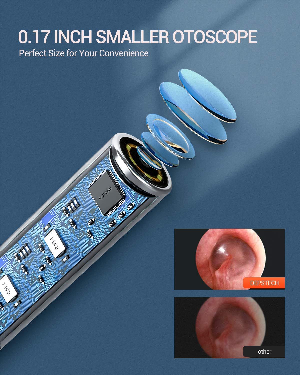 DEPSTECH-Otoscope USB NTE390 720P HD, caméra pour Inspection d'oreille, avec 6 endoscopes LED ajustables, pour téléphone Android et Windows/Mac et PC