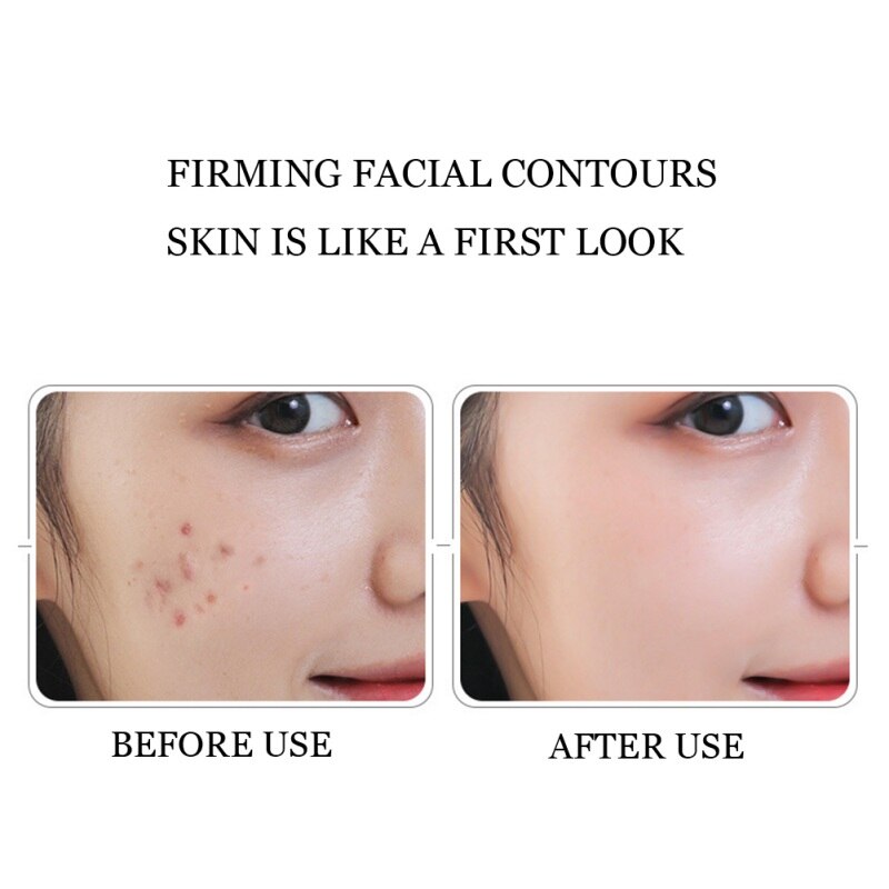 LED Face Beauty Massager Cold Hammer Ultrasonic Cryotherapy Facial Vibration Massager Face Body Spa Ion Beauty Instrument