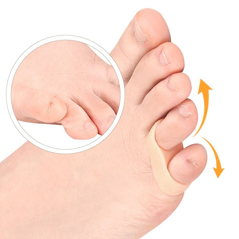 2 pz = 1 paio correttore in silicone caldo alluce valgo gel cura del piede separatore per dita protezione per dita piccole borsite raddrizzatore Pedicure