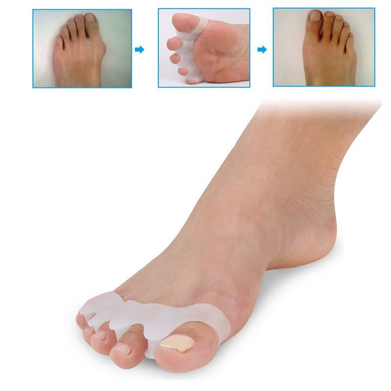 2 Stks/set Siliconen Teen Separator Duim Valgus Corrector Protector Teen Voet Orthese Teen Tool Pad Zorg Verpleging Bone A1N8