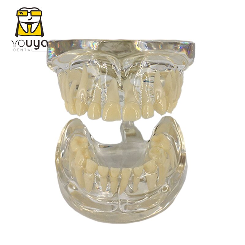 Dental Model For Children Deciduous Tooth Permanent Teeth Alternating Study Teathing Pediatric Dental Pathology Preventive Model