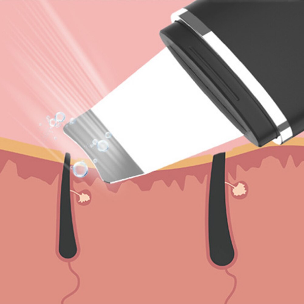 Ultrasonic Skin Scrubber Deep Face Cleaning Machine Peeling Shovel Facial Pore Cleaner Face Skin Scrubber Lift Machine