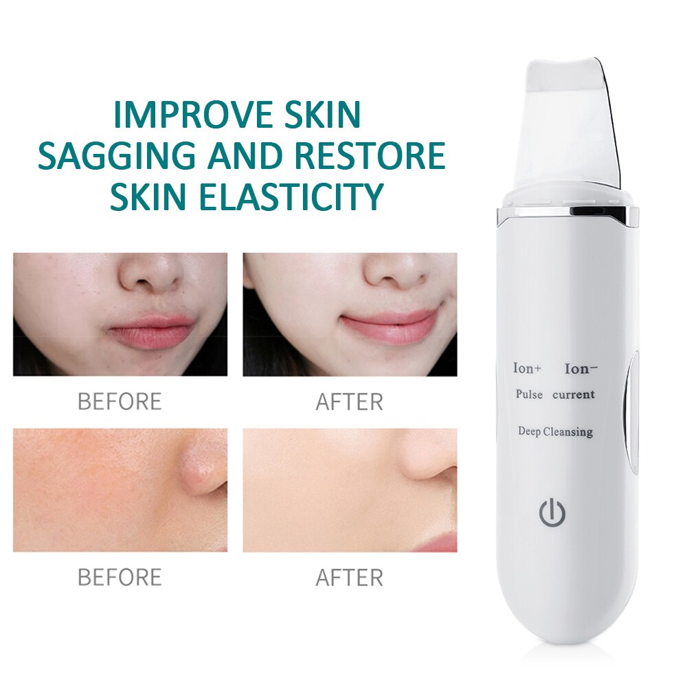 Ion - Import and Ion + Export Ultrasonic Skin Scrubber EMS Peeling Shovel Facial Pore Cleaner Face Skin Scrubber Lift Machine