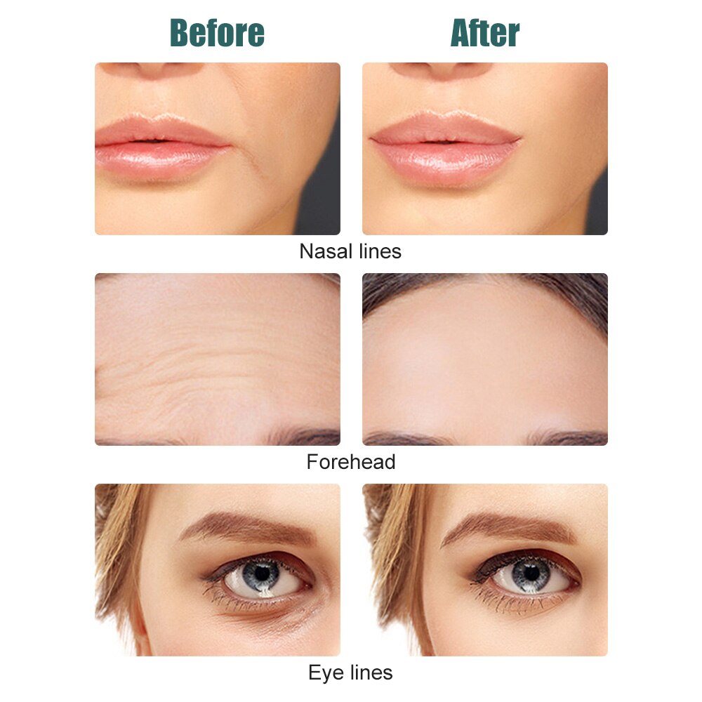 Facial Massager Roller Facelift Microstroom Machine Ems Massage V Gezicht Lifting Gezicht Spanners Huid Schrapen Thuisgebruik Apparaat