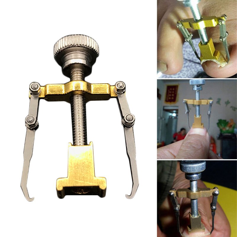 Ingrown Toenails Pedicure Foot Care Tool Nail Correction Clipper Cutters For Orthotic Acronyx Dead Skin Remover Podiatry: 1pcs Pedicure Tool