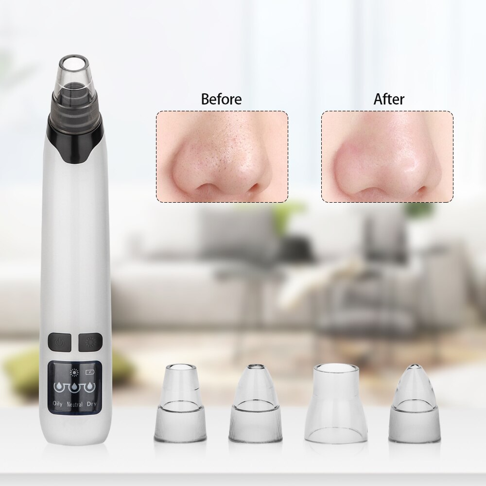Face Blackhead Remover Vacuum Acne Pore Pimple Removal Electric BlackHead Vacuum Cleaner Facial Skin Care Tool