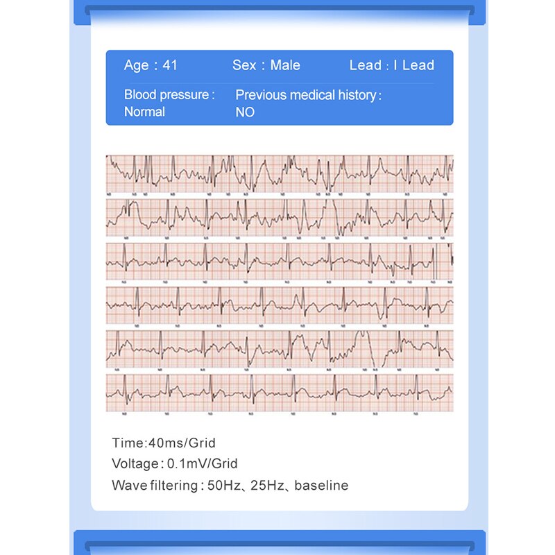 KAIHAI termometro PPG ECG tasso di HRV respiro braccialetto intelligente di misurazione della pressione sanguigna orologio wristband fitness Attività pista fascia