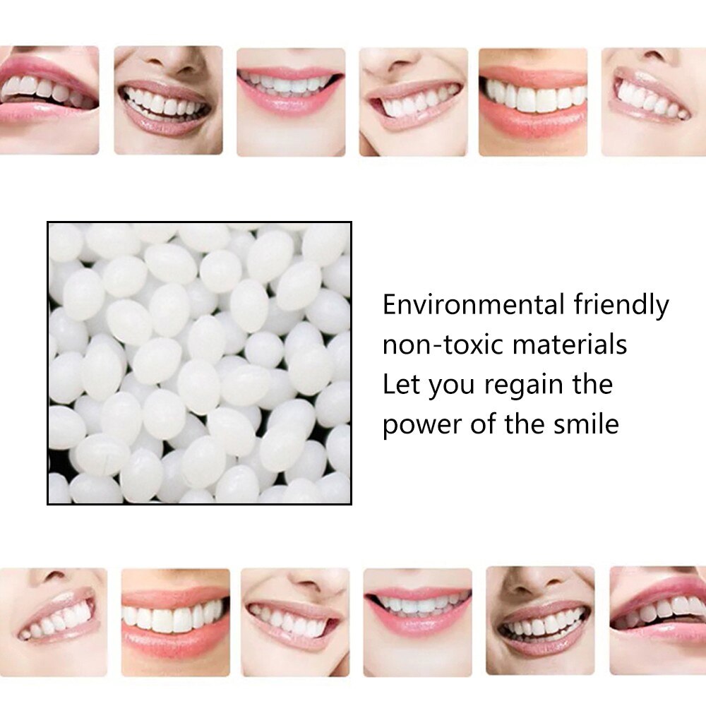 10/50/100g Temporäbetreffend Zahn Ersatz Material Zahn Füllung Temp Ersetzen Fehlende Prothese Klebstoff DIY Zähne Reparatur Zahn