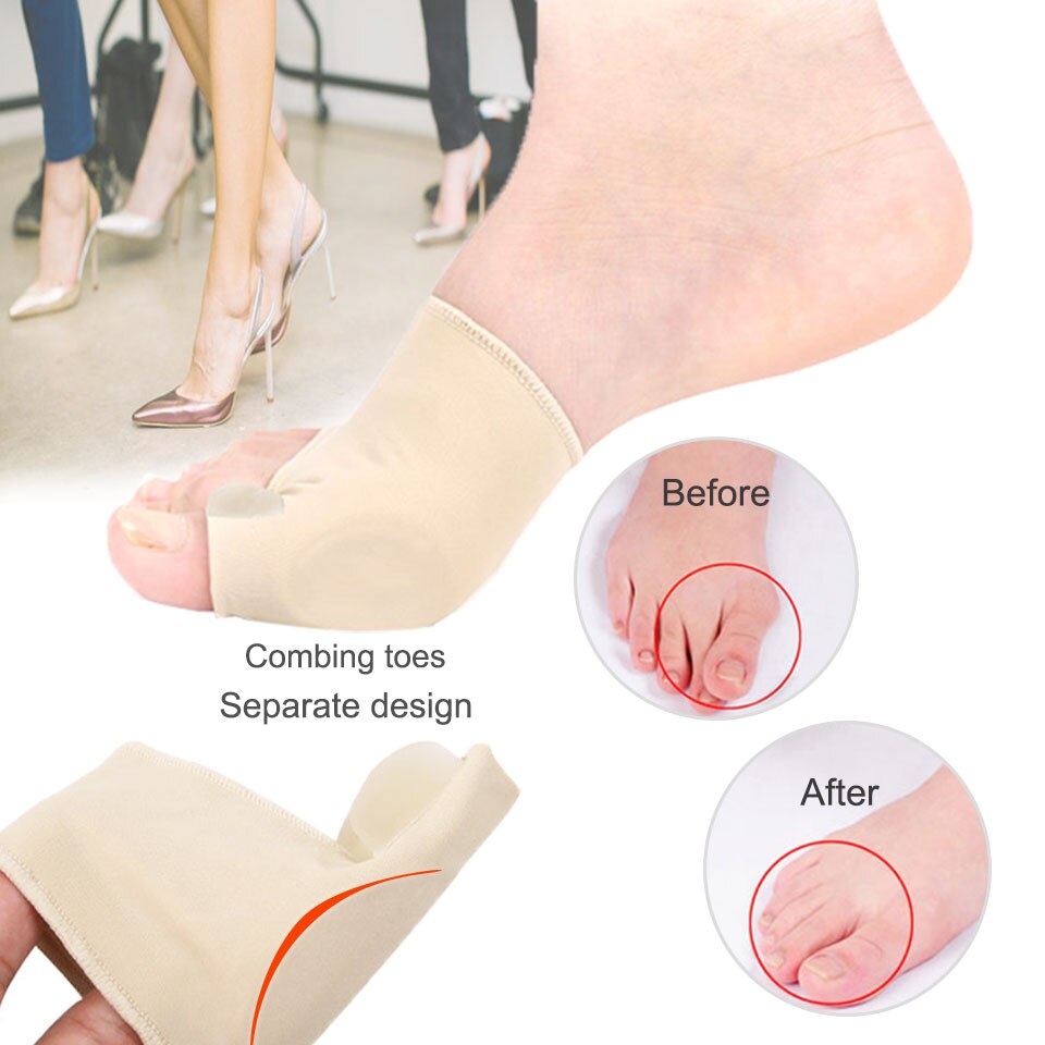 Corrector ortopédico de juanete, calcetines de silicona para pedicura, Corrector de Hallux Valgus, para el cuidado de los pies, separadores de dedos, plantilla ortopédica