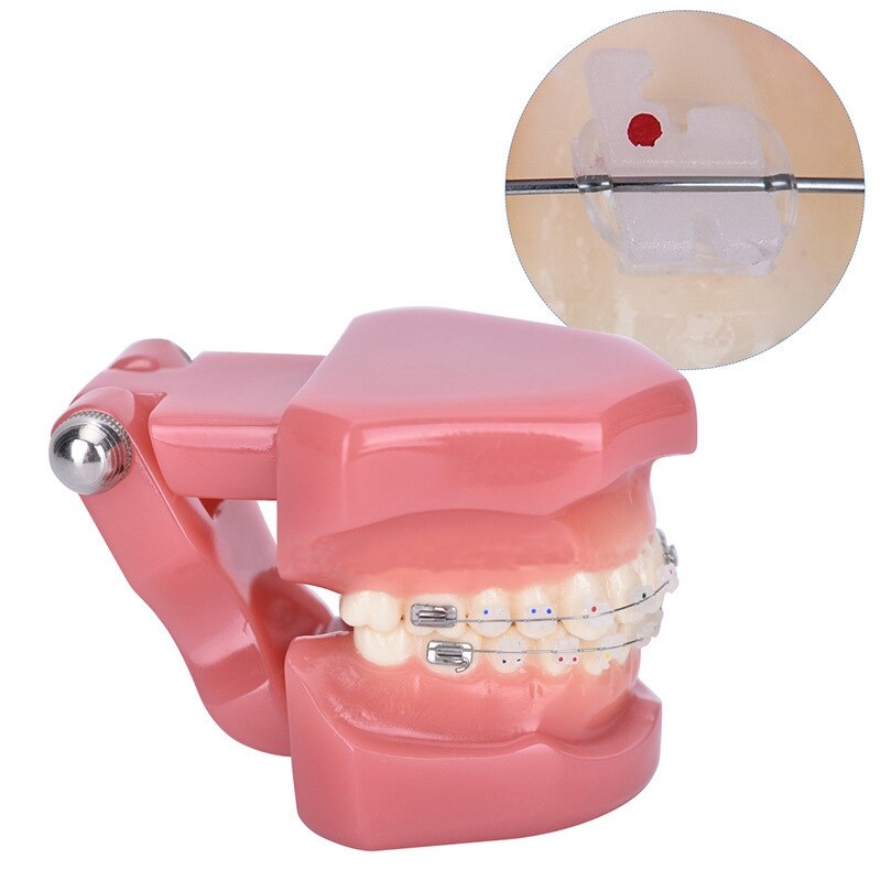 Teeth Model Implant Disease Teeth Model Dentist Studying Model