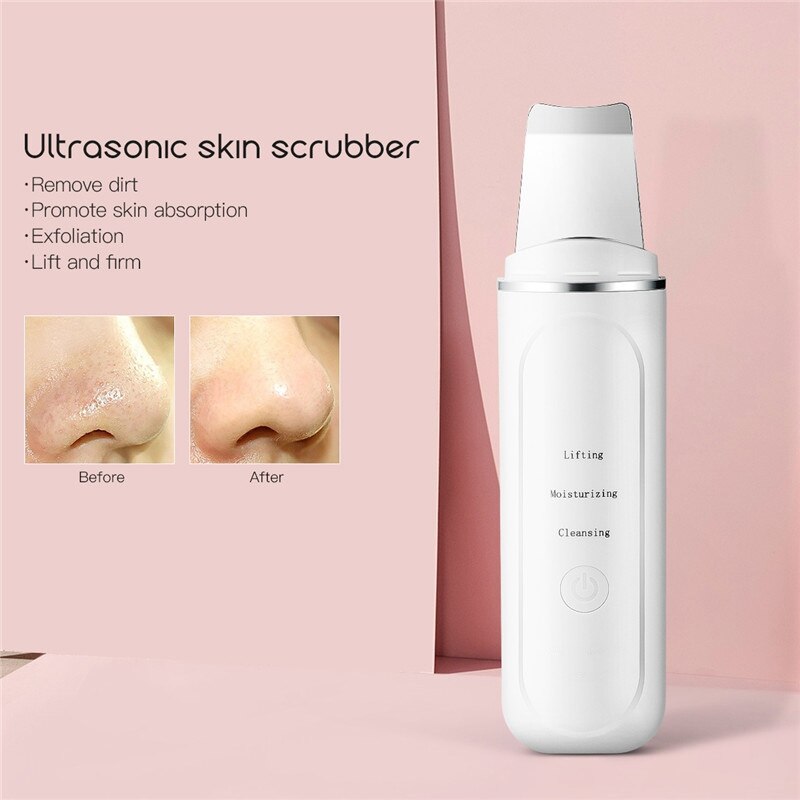 Ultrasone Trillingen Gezicht Scrubber Massager Pore Cleaner Lift Vuil Neus Comedondrukker Ems Mini Valuta Peeling Machine