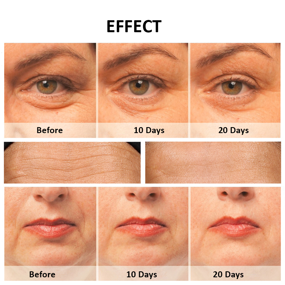 Facelifting ing Massage gerät Gesichts mikros trömich führte Lichttherapie Anti-Altern-Haut straffen elektrische Gesichts Massage gerät