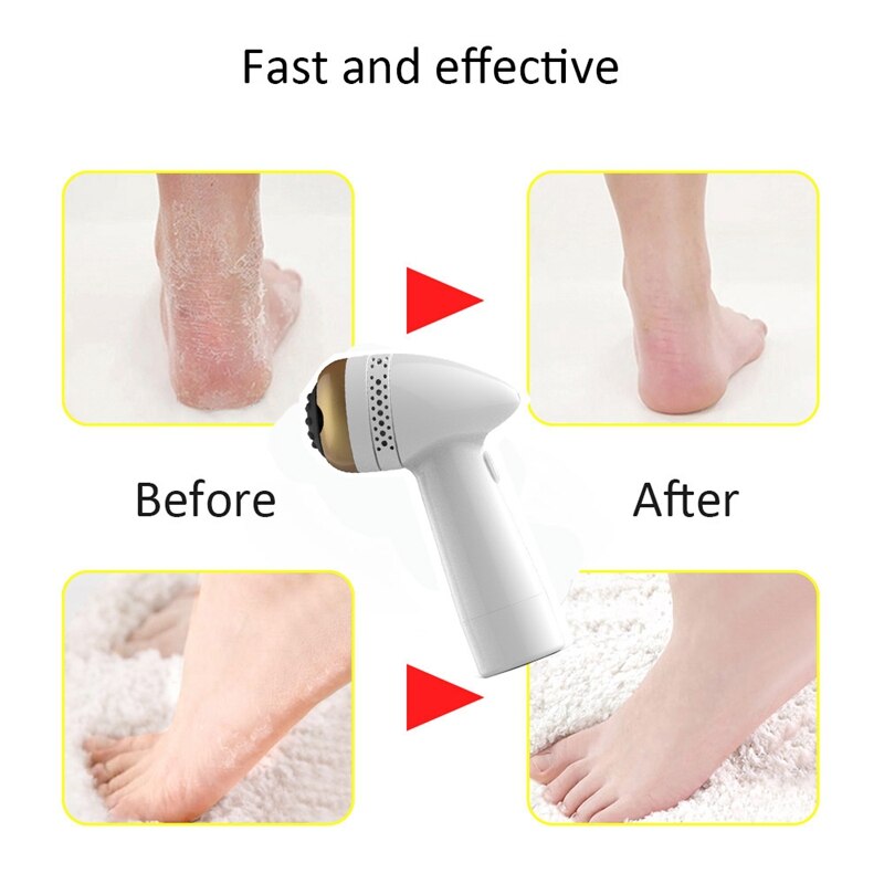 Pédicure électrique pied fichier pédicure callosités dissolvant USB charge pour pieds peau morte callosités dissolvant