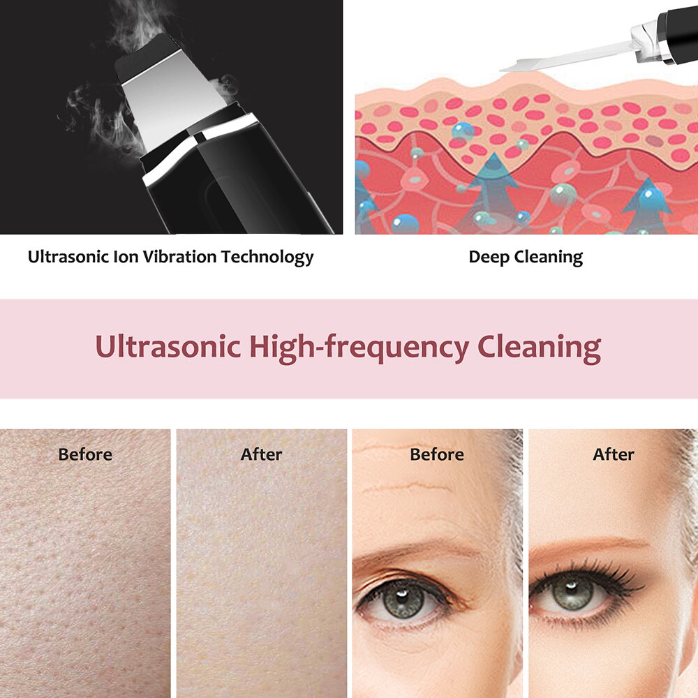 Ultraljud ansiktsrengöring hudskrubber rengöringsmedel ansiktslyftterapi spa ultraljud peeling rengöringsmaskin #ei -159