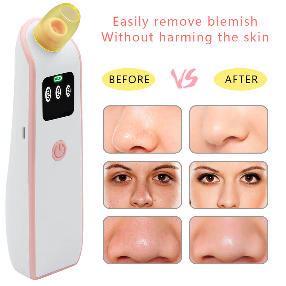 Blackhead Acne Remover Vacuum Machine Black Head Face Skin Care Cleaner Pore Nose Suction Facial Removal Extractor